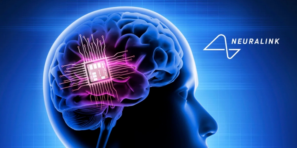 马斯克计划启动意念语音试验，Neuralink将为失语者植入脑机接口设备