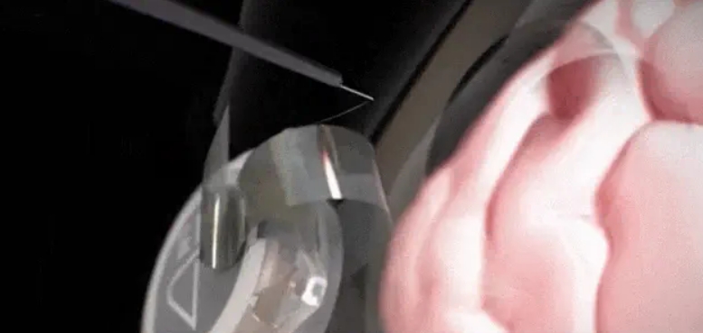 马斯克Neuralink脑机接口手术流程：像缝纫机，头顶开洞，大脑扎针